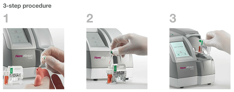 Afinion, afinion analyzer, Alere Afinion AS100 Analyzer, axis shield, affinity chromatography