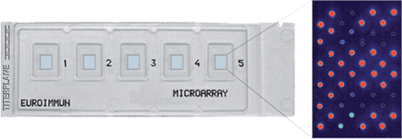 EUROArray technology EUROArray technology,EUROIMMUN microarrays,EUROArrayScan-System