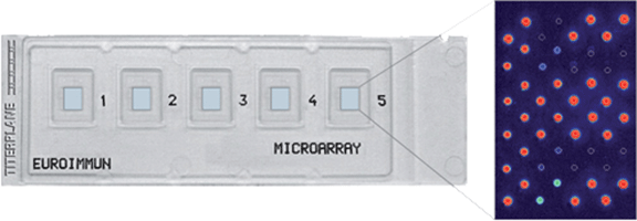 EUROArray technology,EUROIMMUN microarrays,EUROArrayScan-System